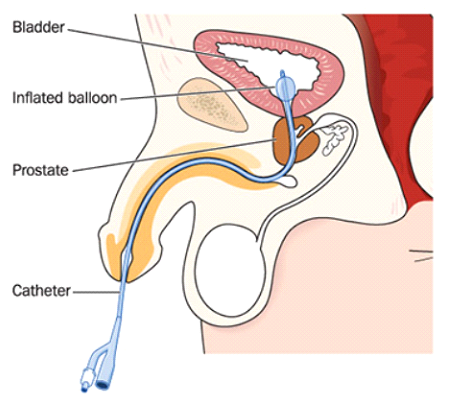 continence care meanings